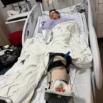 Grant Levescy recovering after a severe motorcycle crash in Edmond with support from his family